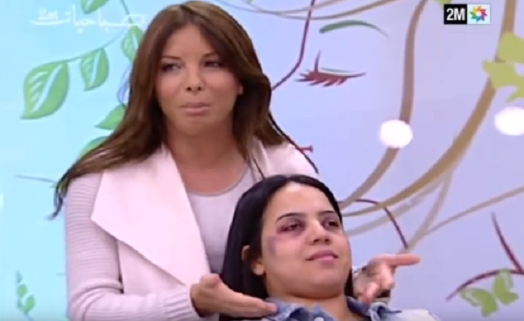 Moroccan Show Angers the World After Airing Makeup Tutorial for Hiding Domestic Abuse