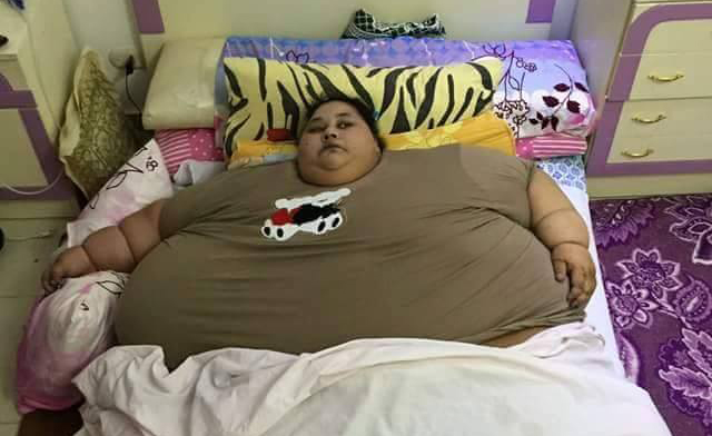 Indian Doctor Offers to Save Morbidly Obese Egyptian Woman Via Twitter